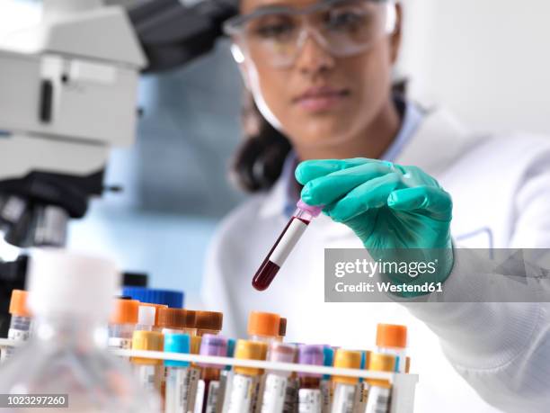feamle scientist preparing a blood sample for clinical testing in the laboratory - análisis-de-sangre-prueba-médica fotografías e imágenes de stock