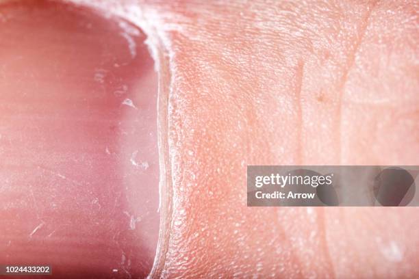 close up marco shots of body parts - fingernail-anatomy stock pictures, royalty-free photos & images