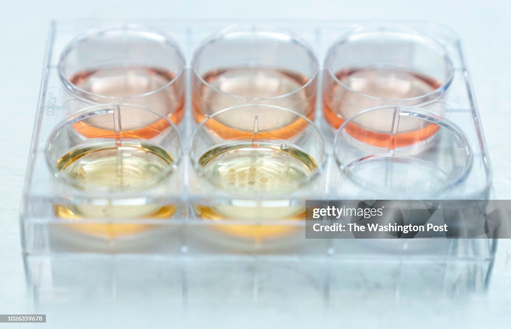 Researchers at UPenn are growing human brain organoids (sometimes called minibrains)