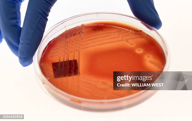 Jean Lee, a PhD student at Melbourne's Doherty Institute, displays the superbug Staphylcocus epidermidis on an agar plate in Melbourne on September...