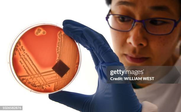 Jean Lee, a PhD student at Melbourne's Doherty Institute, inspects the superbug Staphylcocus epidermidis on an agar plate in Melbourne on September...