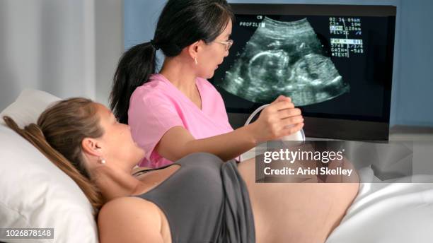 pregnant woman getting a sonogram - baby in womb stock-fotos und bilder