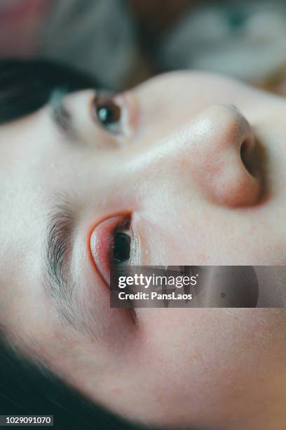 medical hordeolum ill eyes - stye stock pictures, royalty-free photos & images