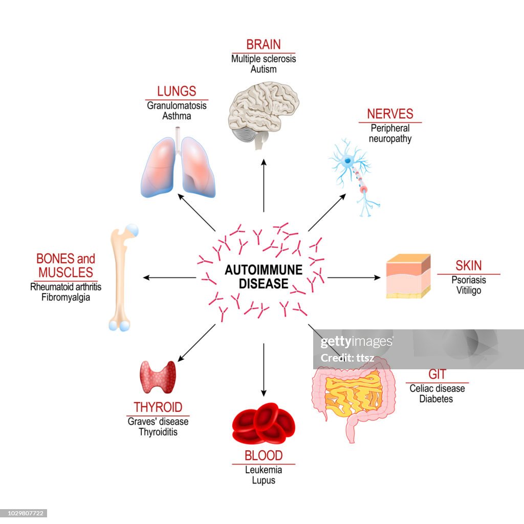 Tissues of the human body affected by autoimmune attack