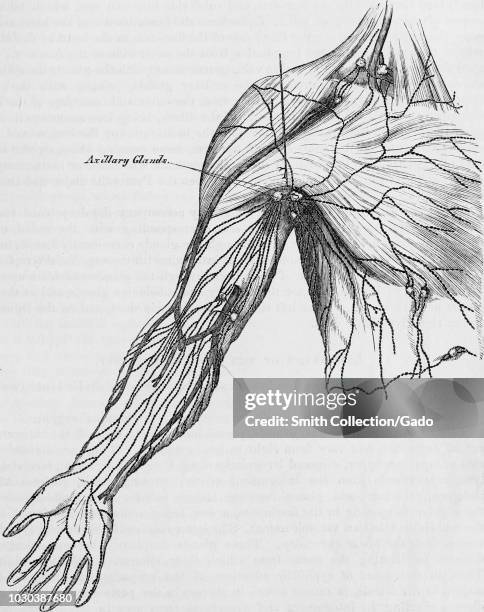 Black and white print of a human arm, armpit, and partial view of the torso, with a line indicating the axillary lymph nodes or armpit lymph nodes,...