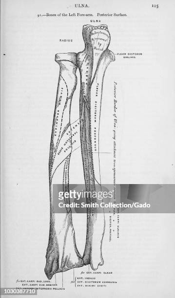 Black and white print showing the bones of the left forearm, the ulna and radius, on the posterior surface, illustrated by Henry Vandyke Carter, and...