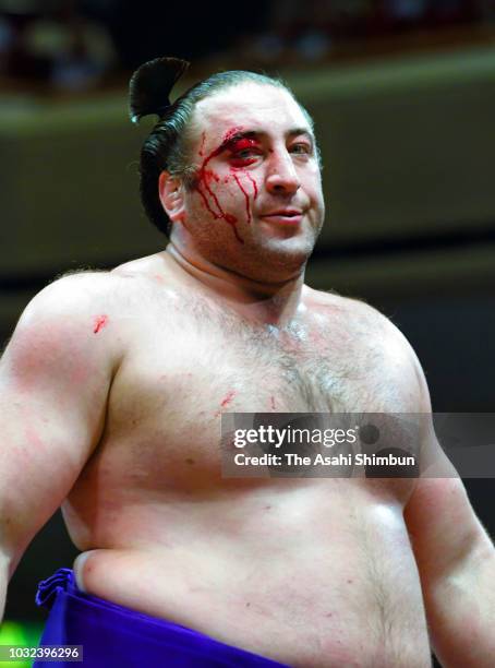 Ozeki Tochinoshin has a cut eye after his victory over Mongolian komusubi Tamawashi on day four of the Grand Sumo Autumn Tournament at Ryogoku...