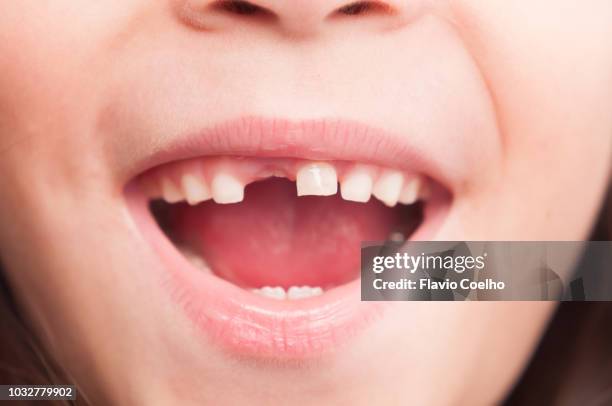 kid showing lost primary tooth - losing your virginity stock-fotos und bilder