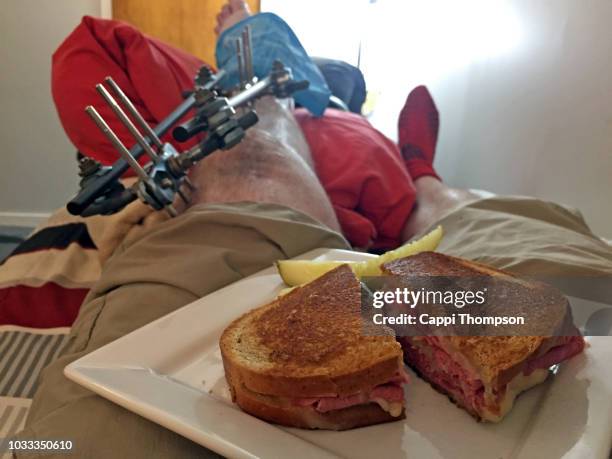 Spaghetti Injury 40 Tibia Fracture Recovery Stock Photos, High-Res Pictures, and Images ...