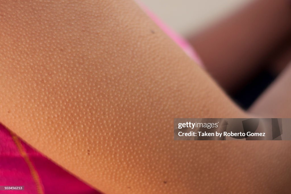 Goose Bumps