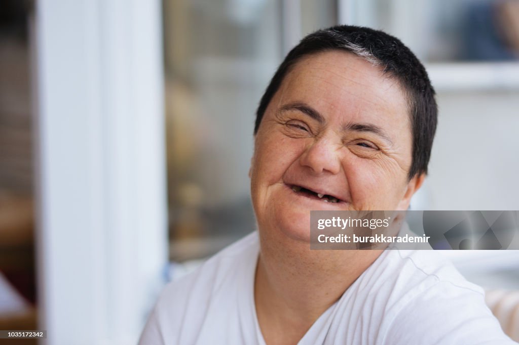 Woman with down syndrome smiling