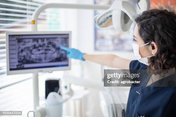 tandheelkundige radiogram op scherm - human jaw bone stockfoto's en -beelden