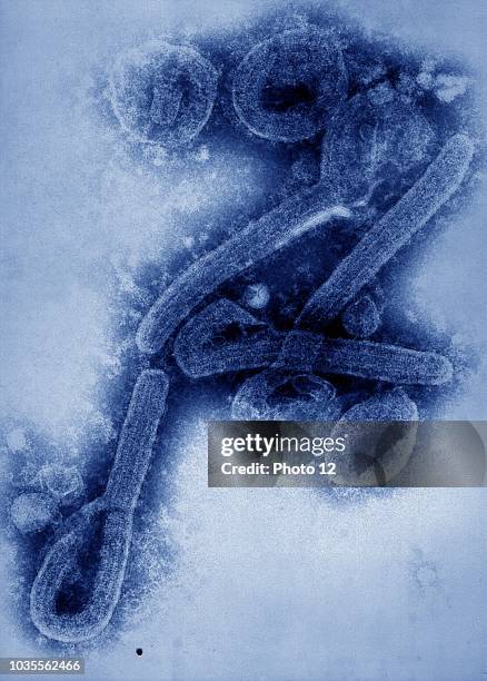 Marburg virus is a hemorrhagic fever virus first described during small epidemics in the German cities Marburg and Frankfurt and the Yugoslavian...