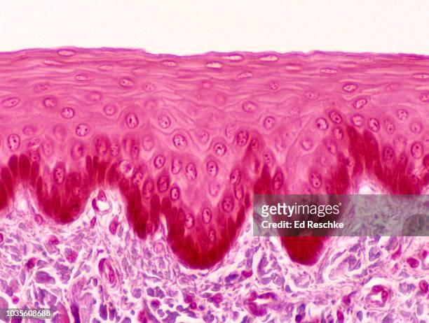 epithelium--stratified squamous epithelium lining the esophagus, 100x - plaveiselcelepitheel stockfoto's en -beelden