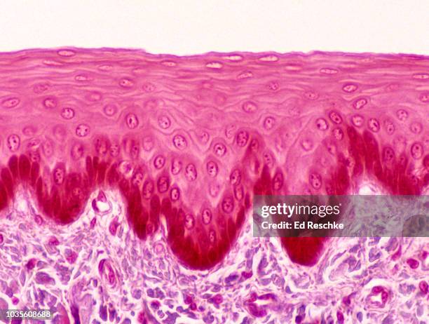 epithelium--stratified squamous epithelium lining the esophagus, 100x - oesophagus stock pictures, royalty-free photos & images