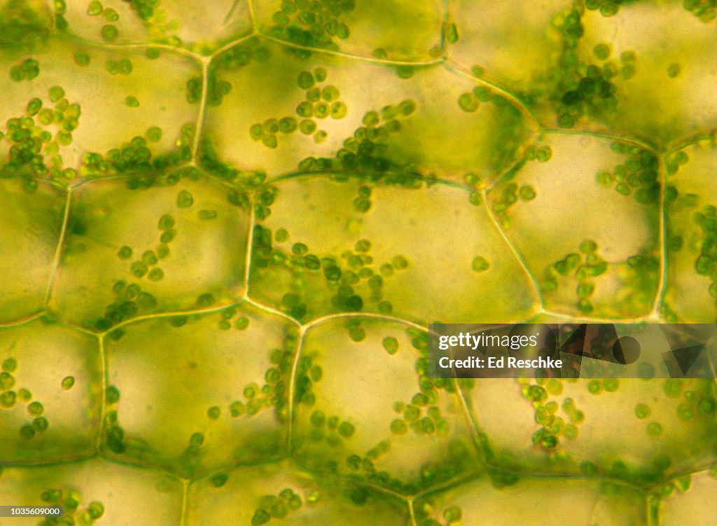 Eukaryotic Cells from a Plant (Elodea sp) showing Chloroplasts and Cell Walls 100X