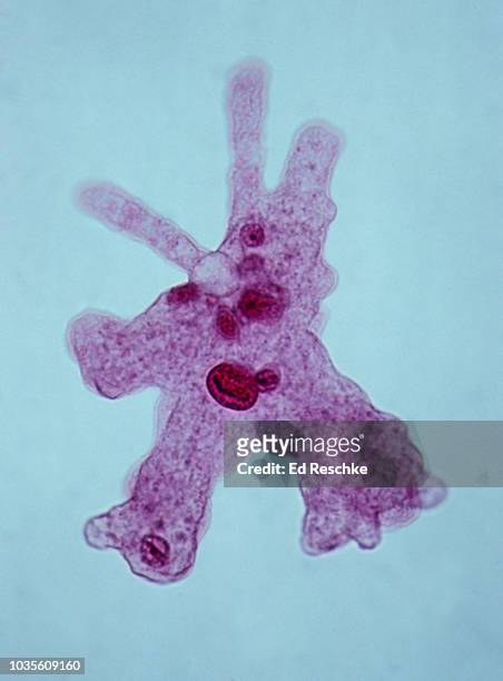 amoeba showing pseudopodia and organelles, amoeba proteus, 100x - amoeba photos et images de collection