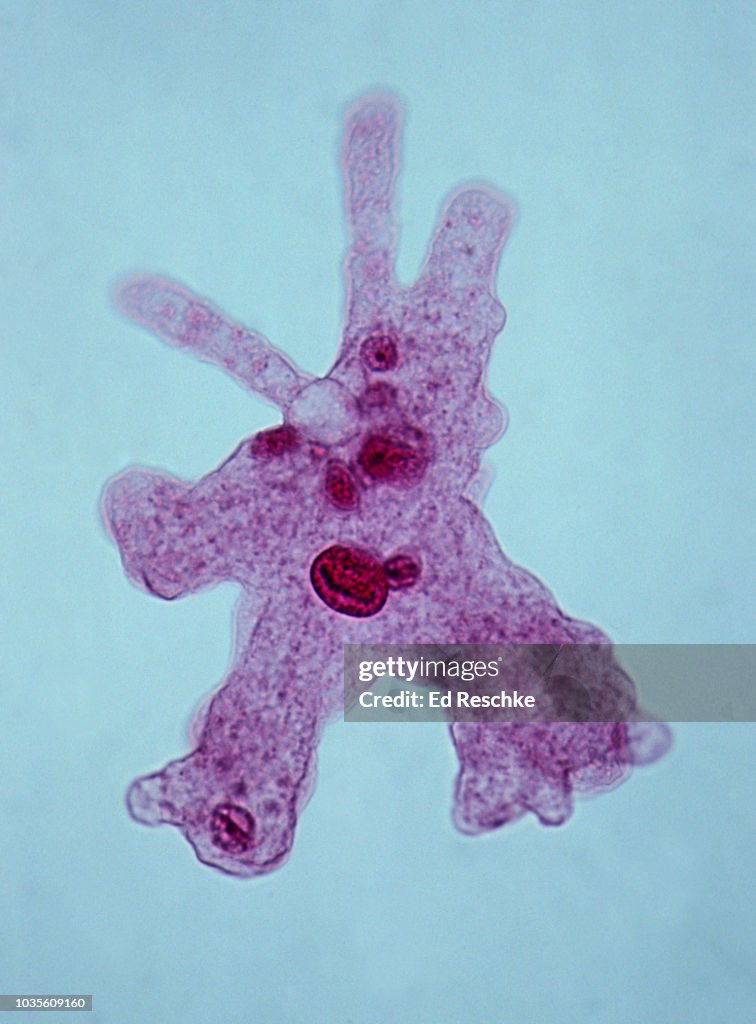 Amoeba showing Pseudopodia and Organelles, Amoeba proteus, 100X