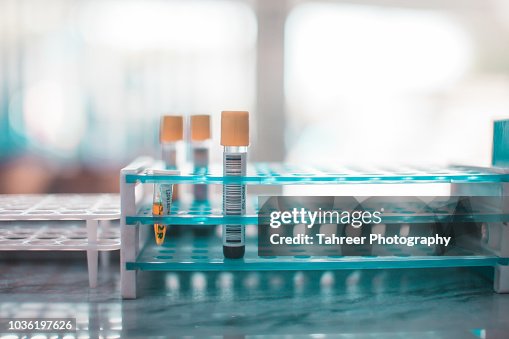 Samples Rack Medical Blood Samples Rack In Medical Lab High-Res Stock Photo - Getty Images