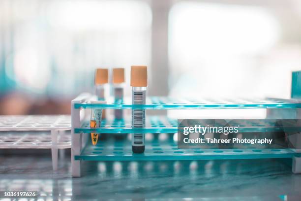 Red Lab Sample Racks Blood Sample Analysis Photos and Premium High Res Pictures - Getty Images