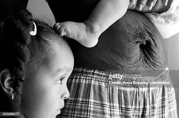 child against mother's scarred belly - ugly black women stock pictures, royalty-free photos & images