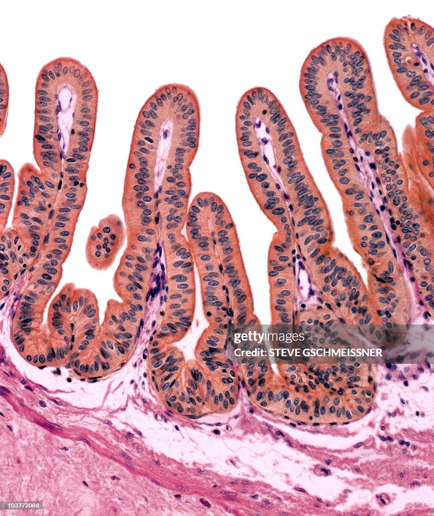 Gall bladder lining, light micrograph
