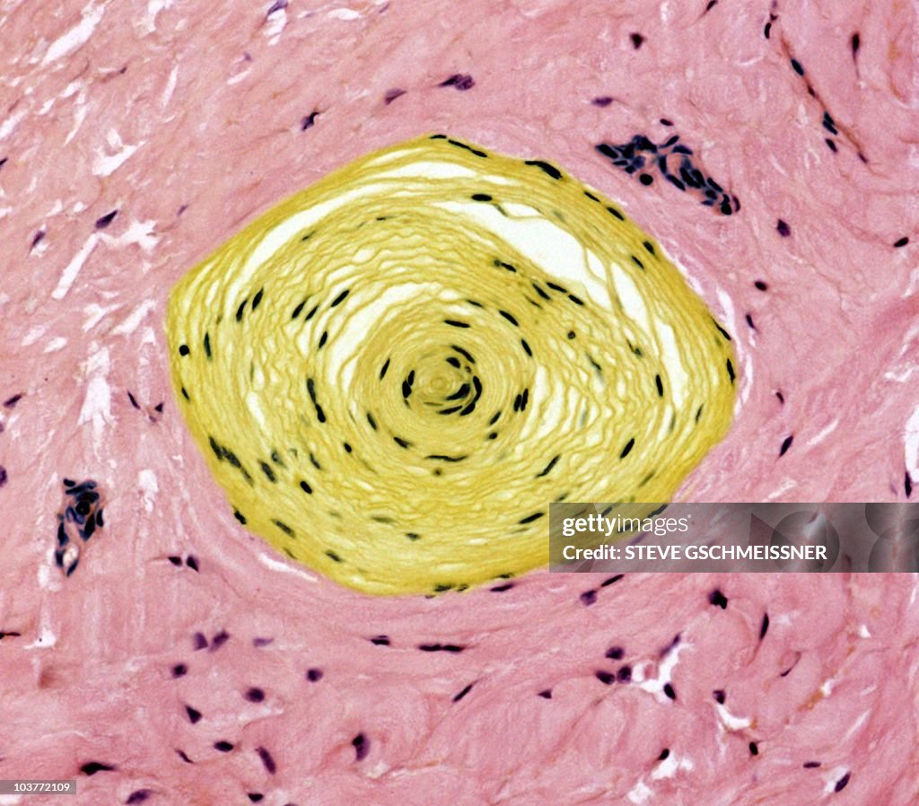 Touch receptor, light micrograph
