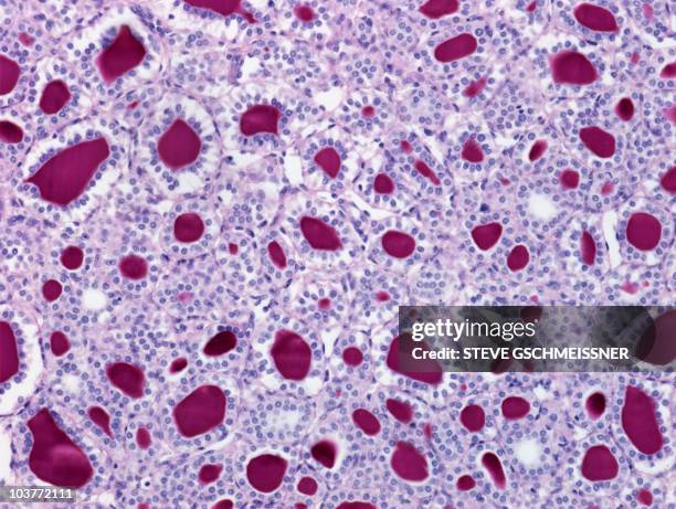 thyroid, light micrograph - tissue anatomy stock pictures, royalty-free photos & images