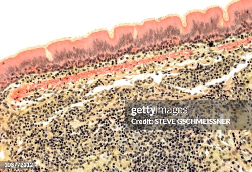 Trachea, light micrograph Trachea, light micrograph