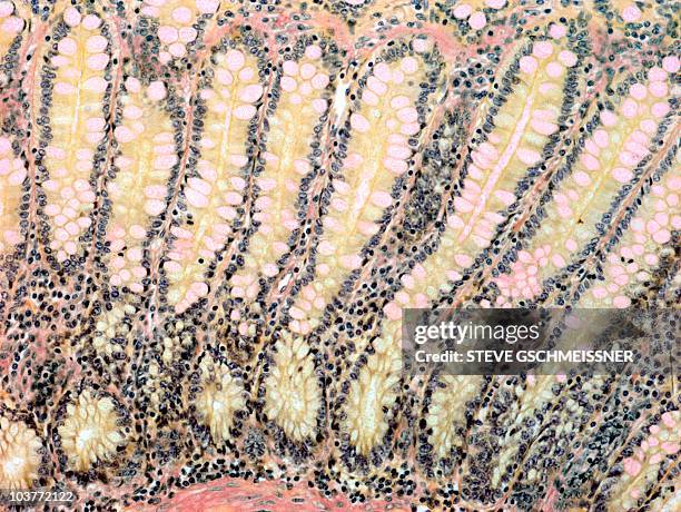 colon lining, light micrograph - lymphozyten stock-fotos und bilder