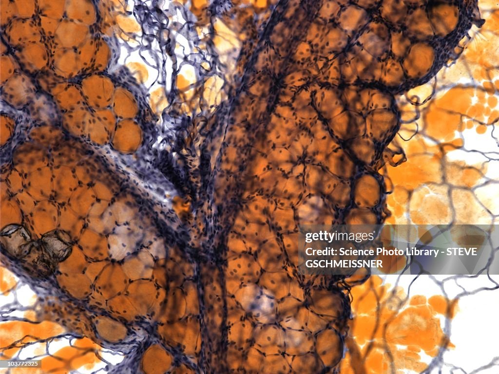 Fat tissue, light micrograph