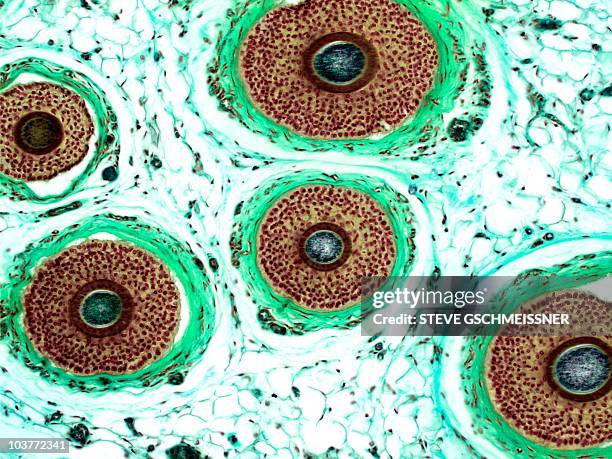 hair follicles, light micrograph - lederhuid stockfoto's en -beelden