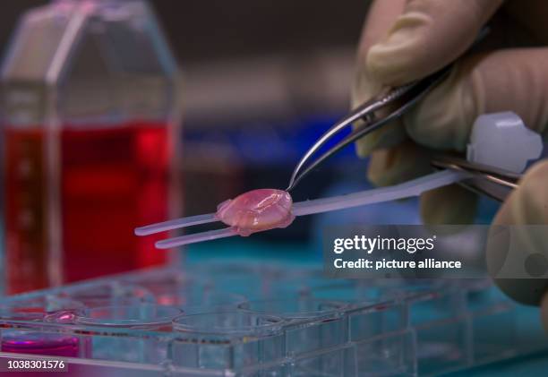 An eye cornea is prepared as a transplant in a laboratory of the Mecklenburg-Western Pomerania Society for Transplant Medicine in Rostock, Germany,...