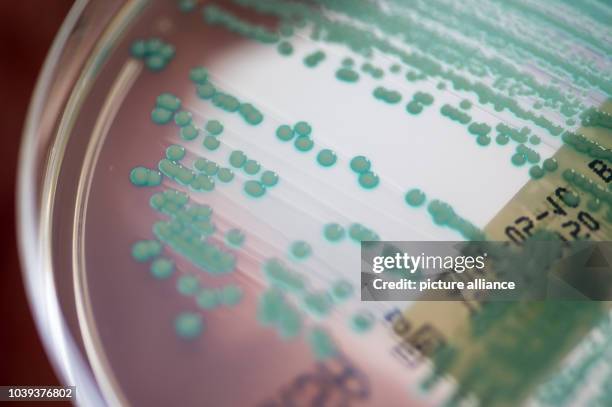 Picture of a petri dish with MRSA bacteria taken at the University Clinic in Regensburg, Germany, 10 April 2017. Schneider is Bavaria's...