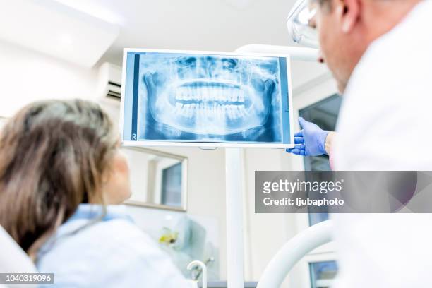 foto von zahnarzt röntgenaufnahme patienten zeigen - dentists office stock-fotos und bilder