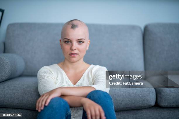 vrouw met geschoren hoofd - alopecia stockfoto's en -beelden