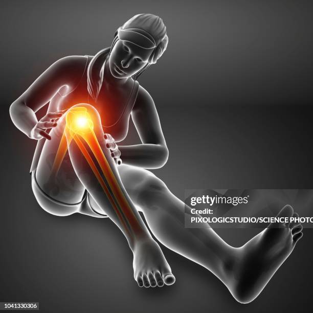 stockillustraties, clipart, cartoons en iconen met woman with knee pain, illustration - female knee pain