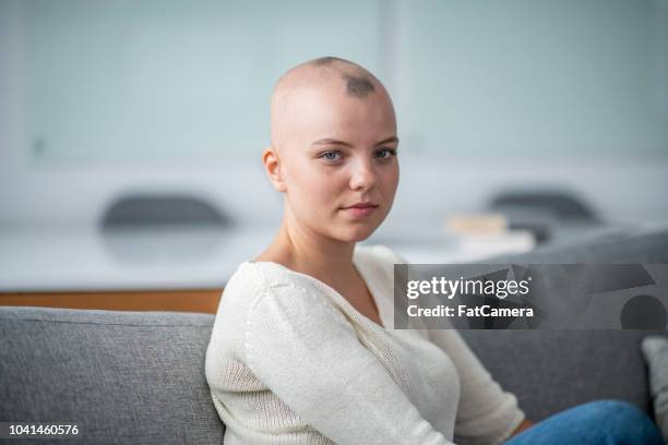 mujer posando en el sofá - alopecia fotografías e imágenes de stock