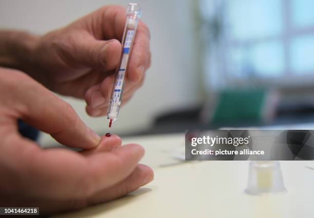 Young man does an HIV home test in Berlin, Germany, 4 May 2017. What is already legal in Great Britain and France may become legal in Germany as...