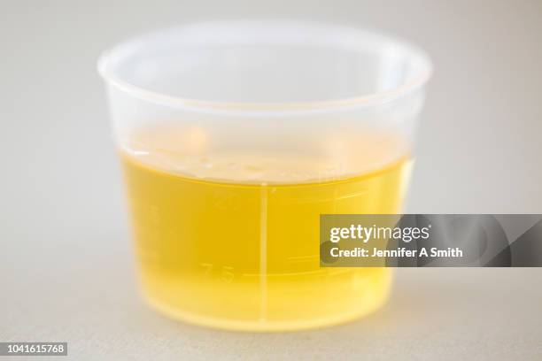 sample - urine sample ストックフォトと画像