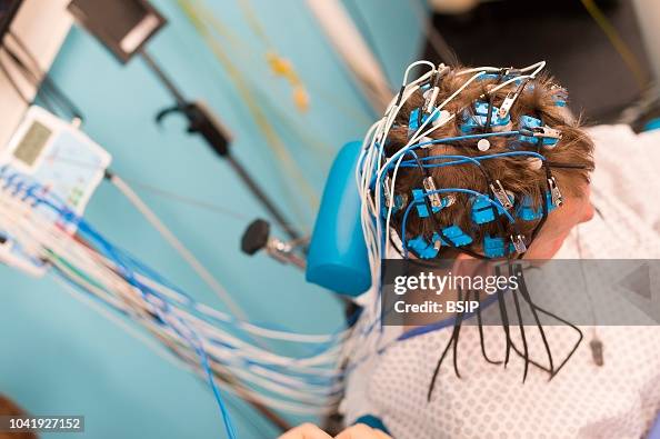 EPILEPTOLOGY EPILEPTOLOGY