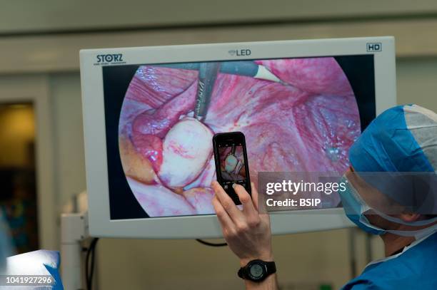 Gynecology surgery, Lenval Clinic, Nice, France Diagnosis laparoscopy for a suspected endometriosis in a patient suffering from infertility A. (Photo...