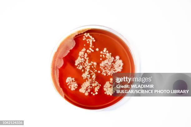 microbes growing on agar plate - agar jelly stock pictures, royalty-free photos & images