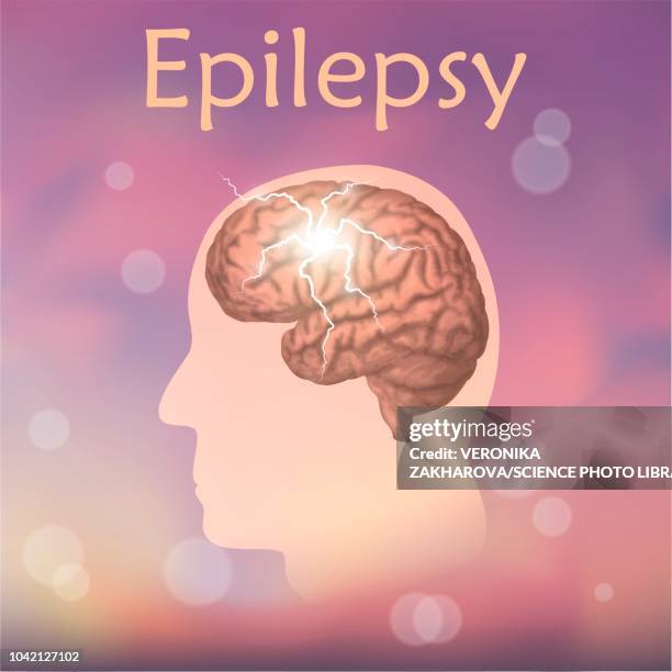 ilustraciones, imágenes clip art, dibujos animados e iconos de stock de epilepsy, illustration - epilepsia