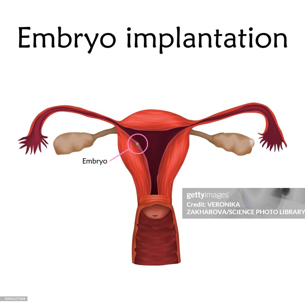 Embryo implantation, illustration