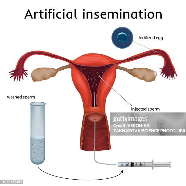 ilustraciones, imágenes clip art, dibujos animados e iconos de stock de artificial insemination, illustration - trompas de falopio