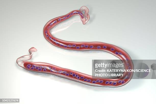 loa loa parasitic worm, illustration - worm stock illustrations
