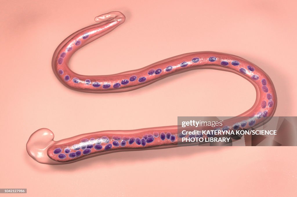 Wuchereria bancrofti parasite, illustration