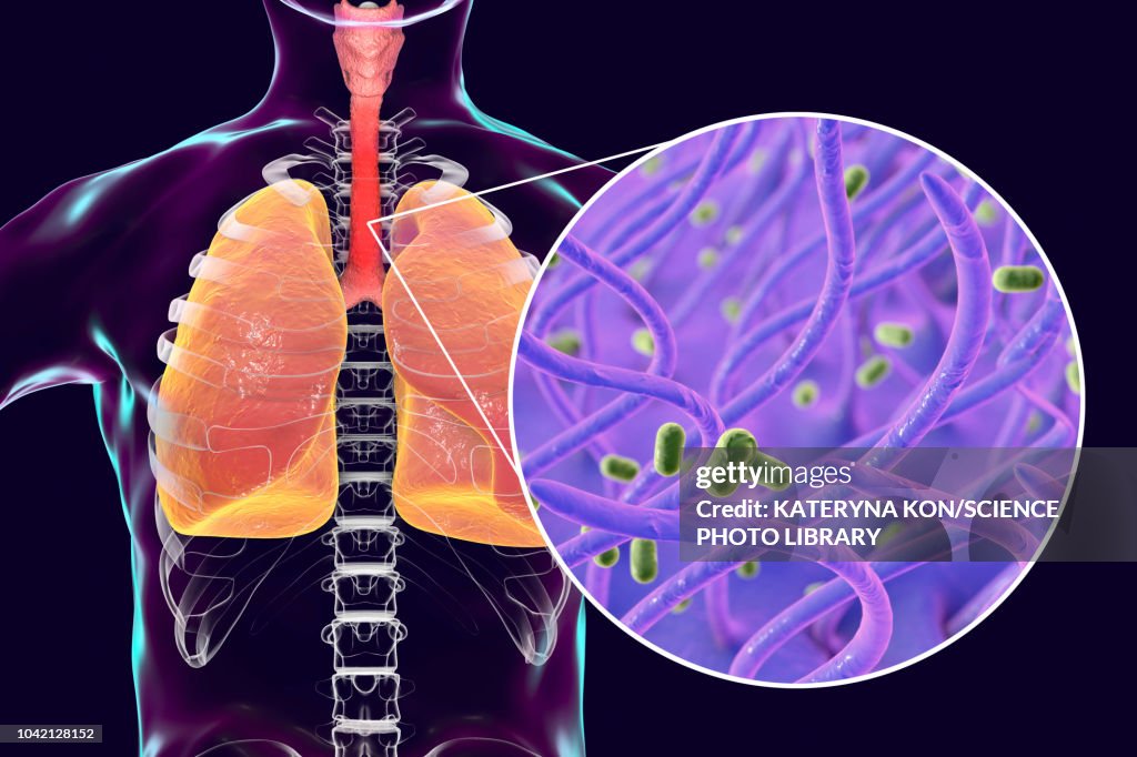 Whooping cough, conceptual illustration