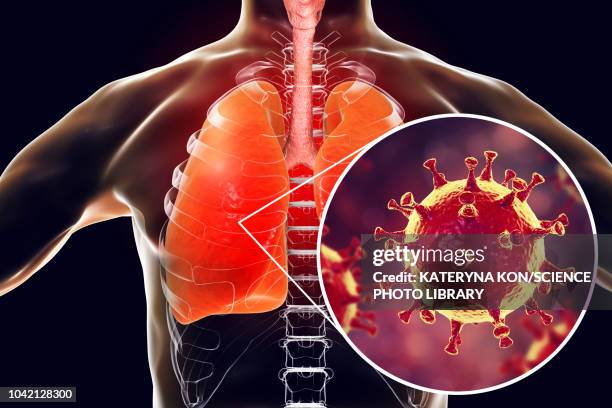 mers virus infection of lungs, conceptual illustration - capsid stock illustrations